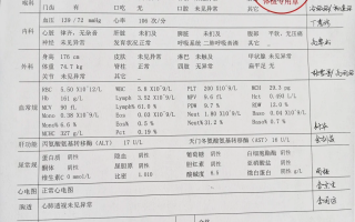 白银找人代替抽血苏州工业园区入职体检